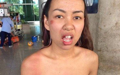 Ca sĩ Thảo Trang bị cướp giật túi xách